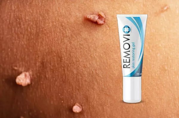 O que é o Removio Gel?