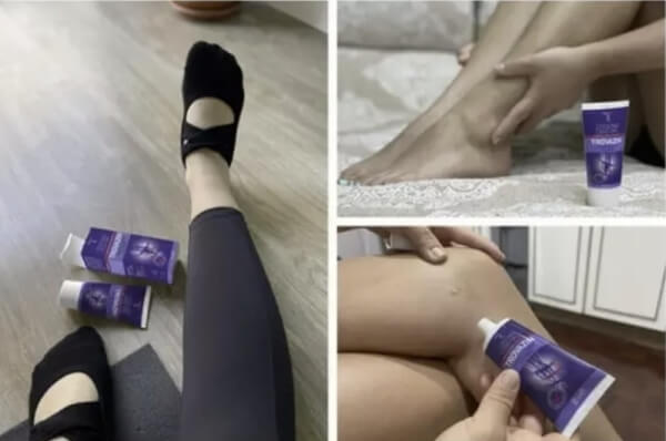 Como usar o gel para varizes Trovazin