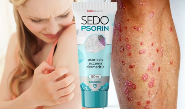 SedoPsorin Cápsulas Portugal - preço onde comprar Opiniões como usar